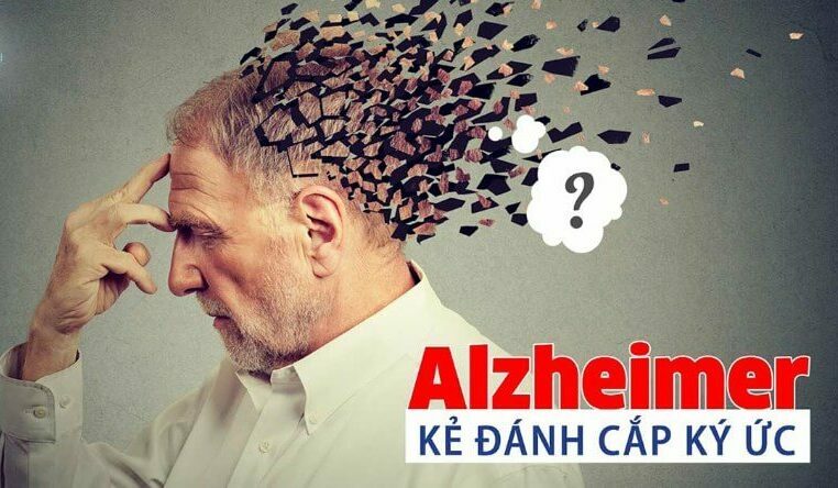 Alzheimer: Nguyên nhân từ đâu?